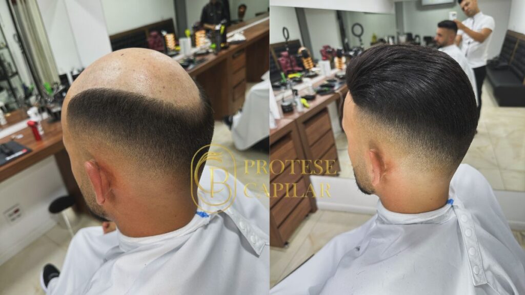 O Segredo dos Homens que Redefiniram a Idade: Com a Prótese Capilar