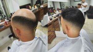 O Segredo dos Homens que Redefiniram a Idade: Com a Prótese Capilar